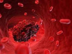 افزایش قابل توجه خطر لختگی خون با تداخل قرص های ضدبارداری و مُسکن ها